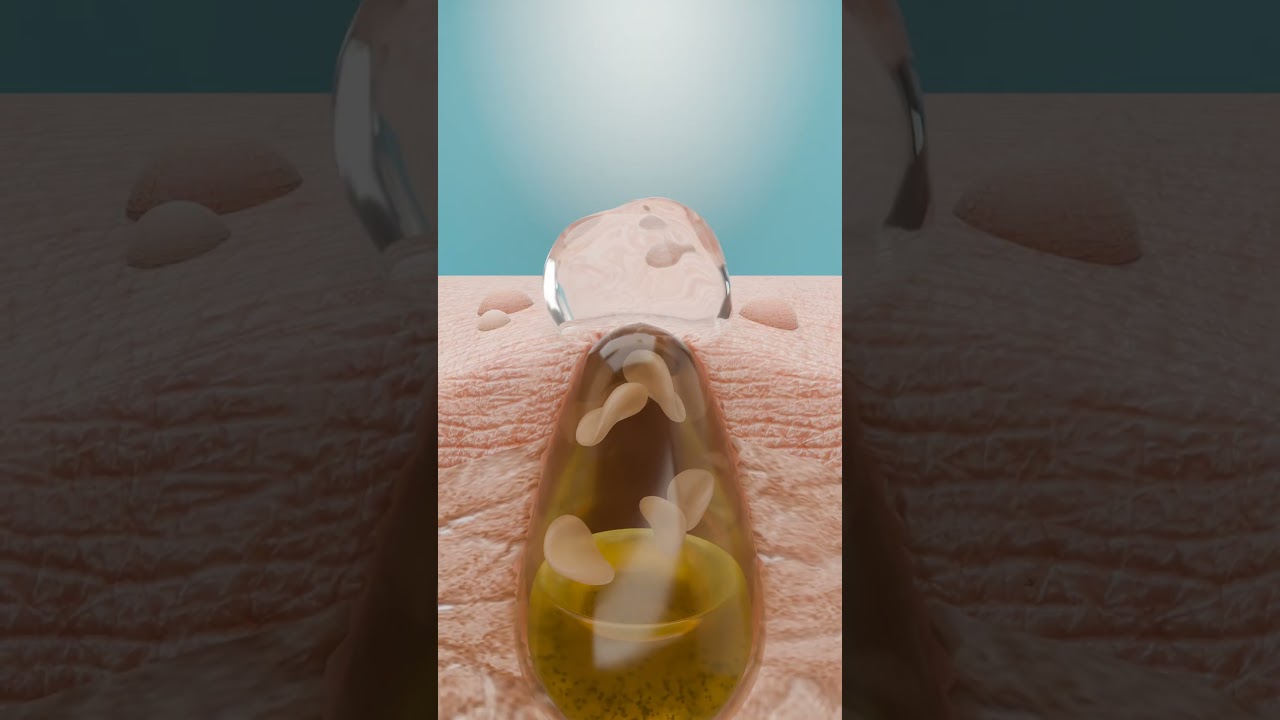 How to Unclog Pores | Paula's Choice Skincare