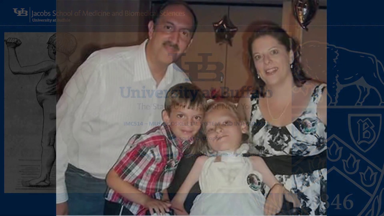 Muscular Dystrophies Segment 07   Muscular Dystrophies   A Human Perspective