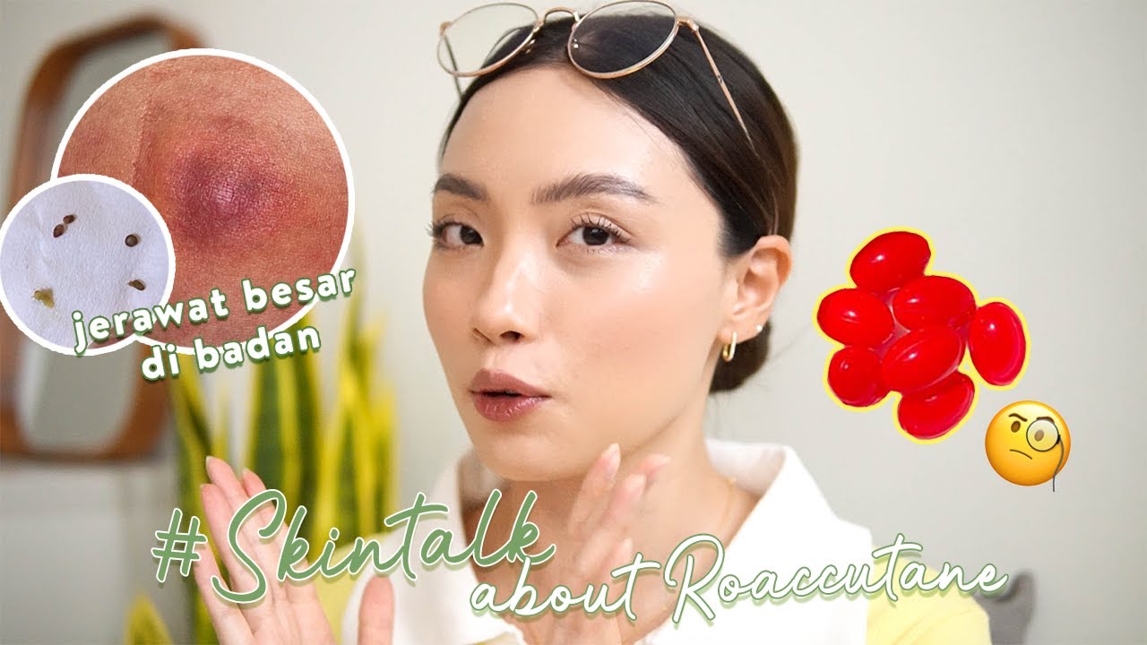 Мой путь к Аккутану. Часть 1 #SkinTalkWithAngel | Почему я в итоге начал принимать Аккутан?