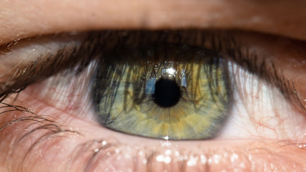 Dezlipirea de retina: cauze, semne si cum se poate evita.