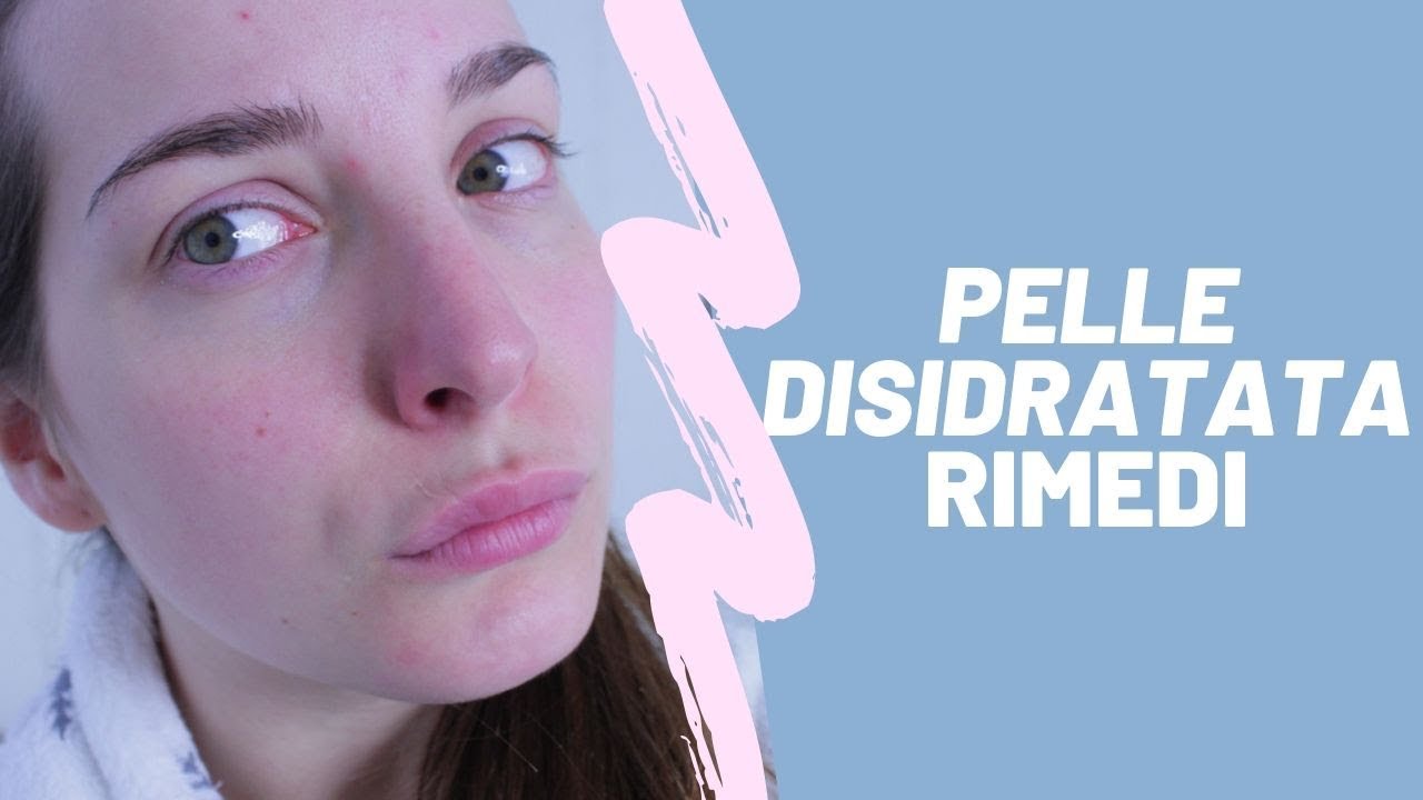 PELLE DISIDRATATA! Ecco come risolvere questo problema!
