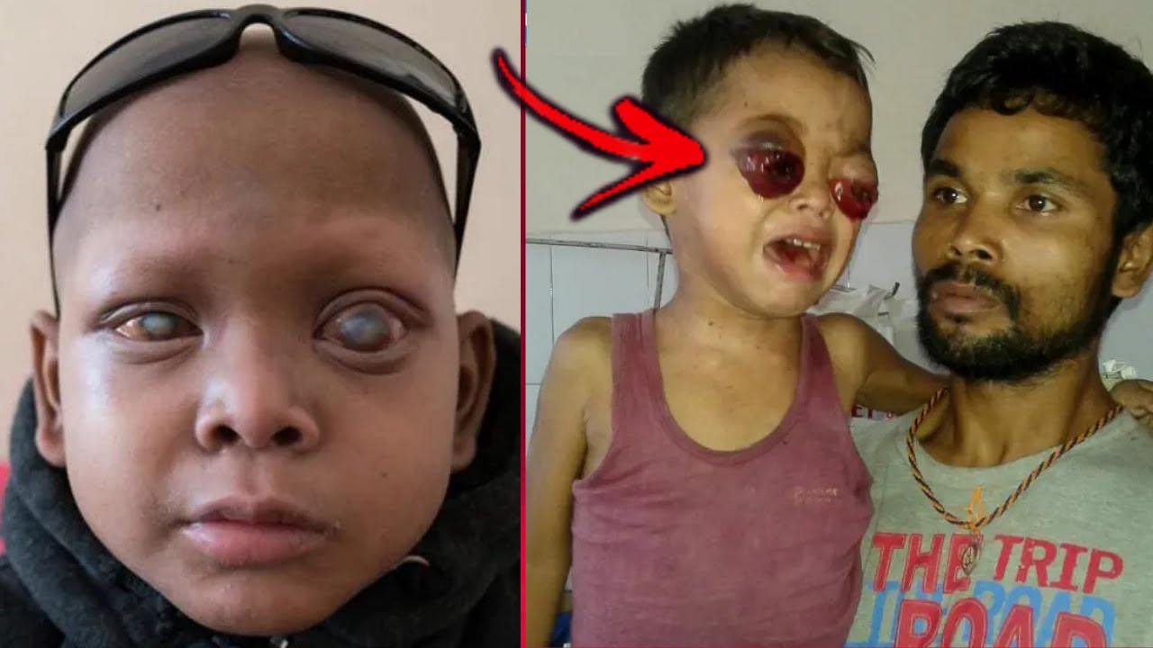 10 Strange People With The Most UNUSUAL Eyes