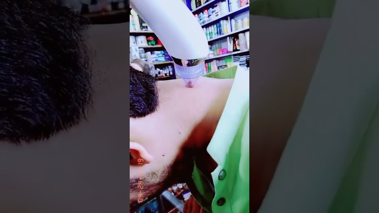 Vacuum Acne Pore Cleaner #youtubeshorts