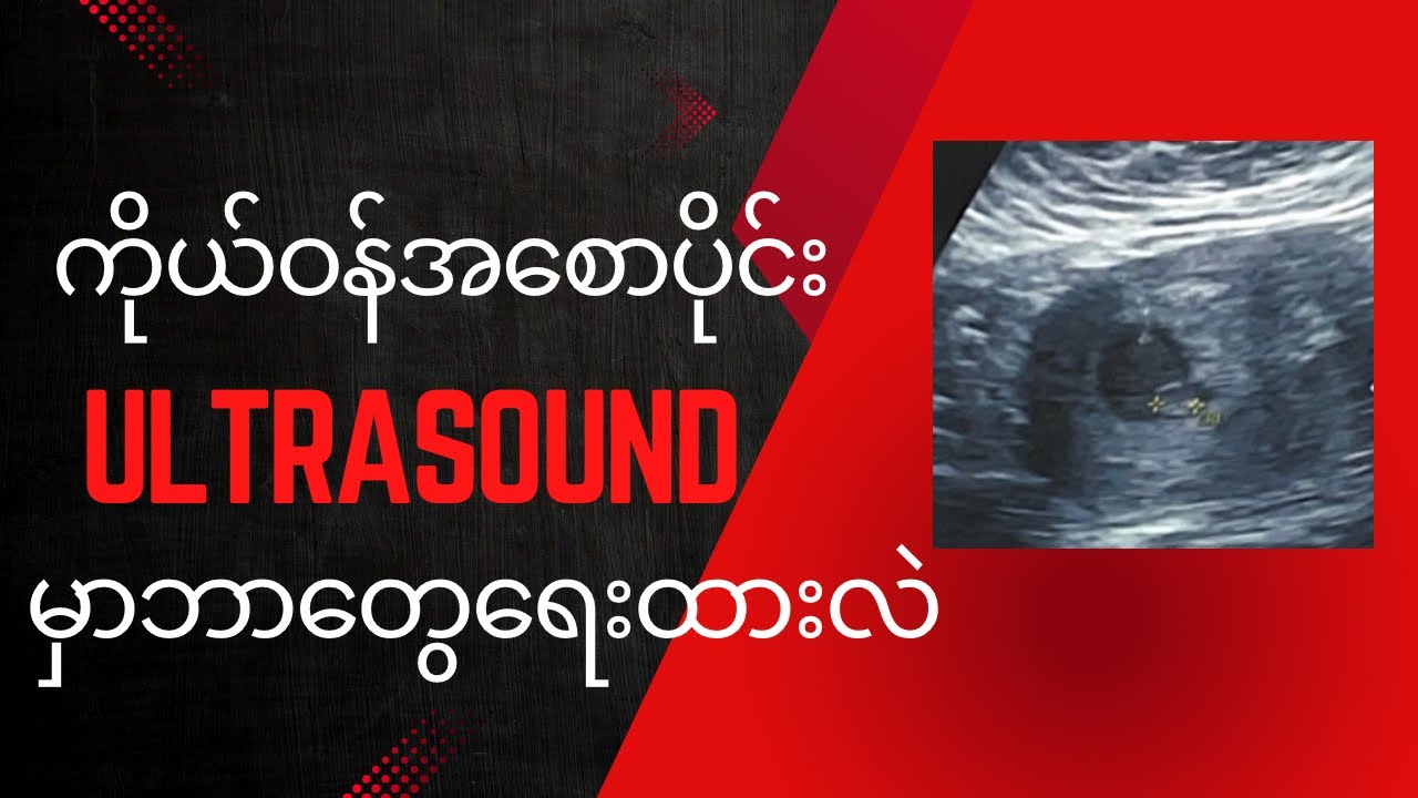 ကိုယ်ဝန်အစရိုက်တဲ့ Ultrasound မှာဘာတွေရေးထားလဲ။ #ကိုယ်ဝန်#ကျန်းမာရေး #healtheducation #drnoreenblog