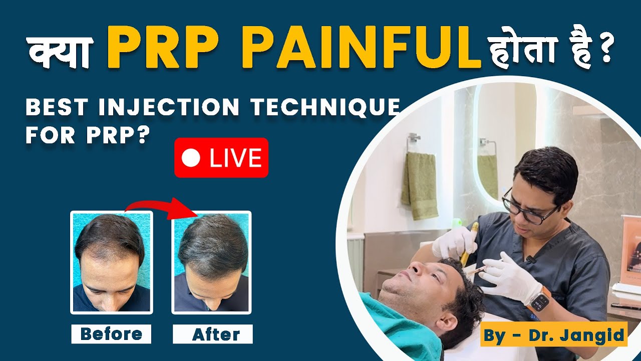 Is PRP Therapy Painful? Full Procedure & Pain Explained | by Dr. Jangid