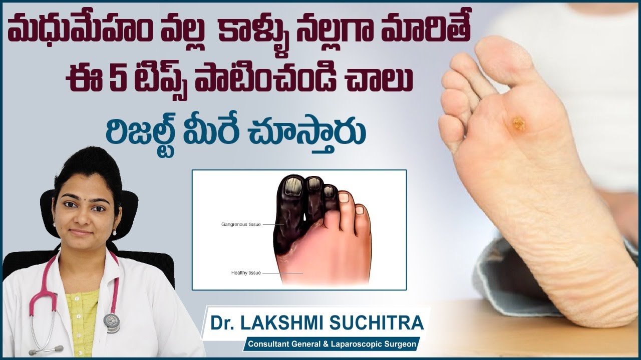 మధుమేహం వల్ల  కాళ్ళు నల్లగా మారితే || Diabetic Foot Ulcer Treatment in Telugu || Diabetic Foot Care
