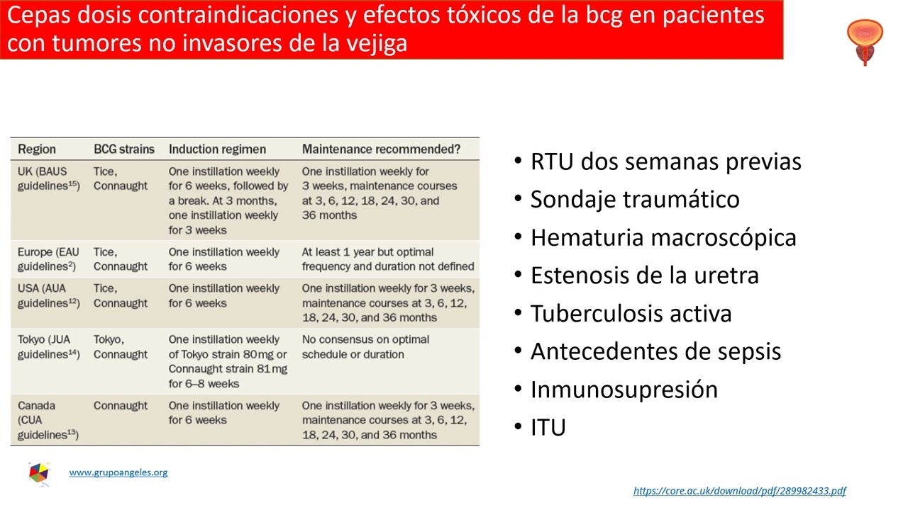 Cancer de vejiga superficial o no músculo invasor BCG, mitomicina, gemcitabina, Dr. Hugo Castro Onco