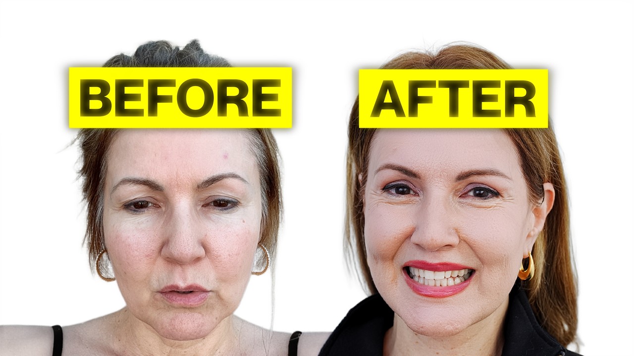 My Facelift Results Look NATURAL | Here's Why I'm Obsessed