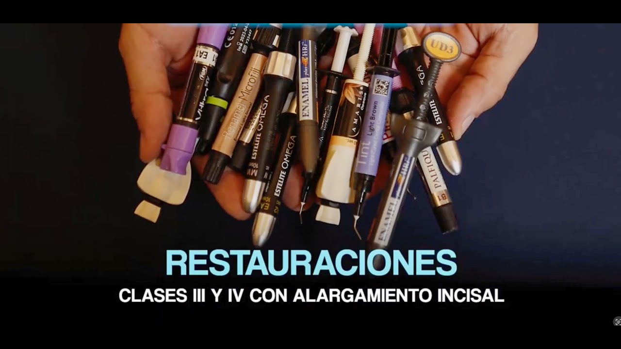 Restauraciones Clase III y IV con Alargamiento Incisal - Parte 1