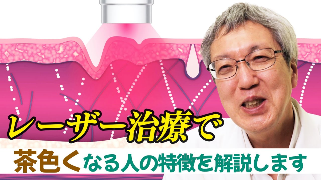 【シミ】レーザー治療で、肌が茶色くなってしまう人の特徴について解説します【しわ・たるみ】