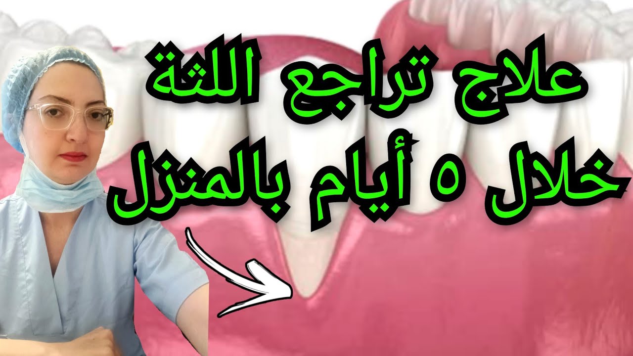 طريقة سحرية لعلاج تراجع و انحسار اللثة في أسرع وقت بنفسك في المنزل ( بدون طبيب )