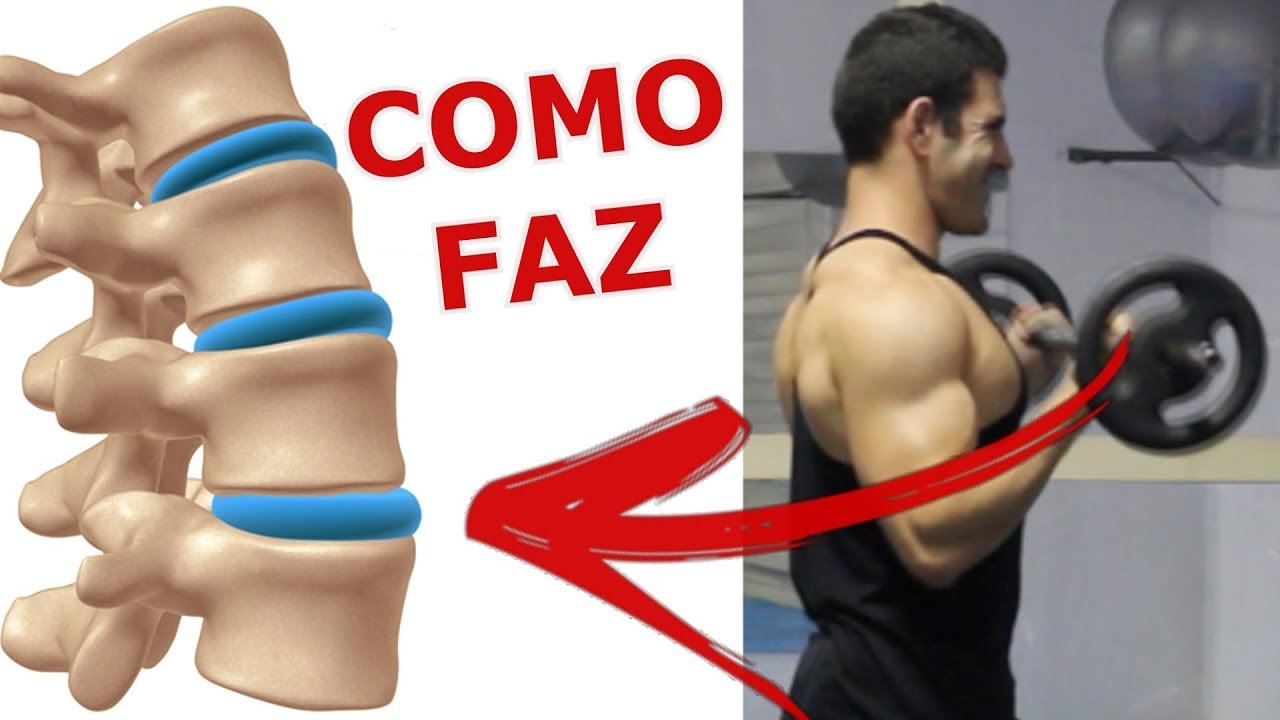 COMO TREINAR MUSCULAÇÃO COM HÉRNIA DE DISCO