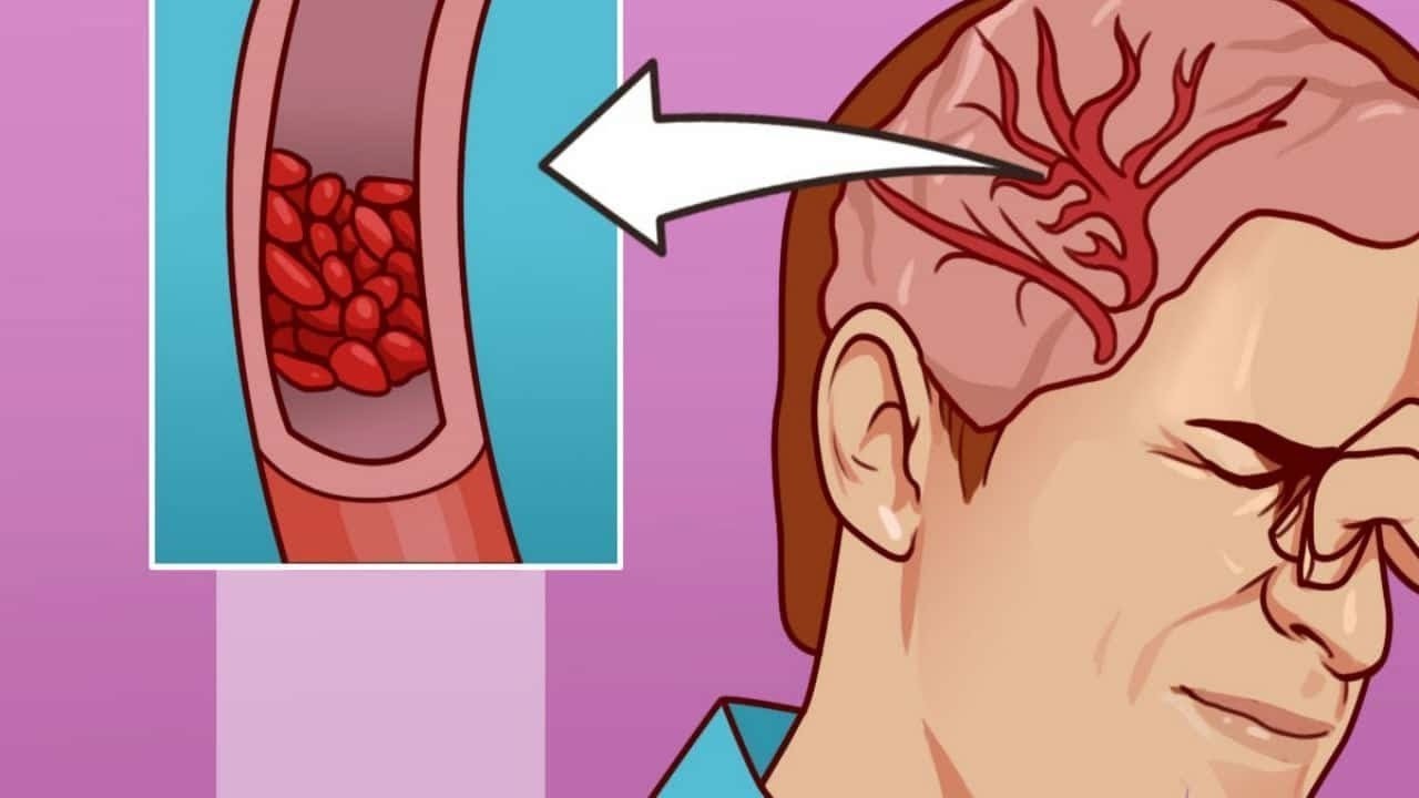 10 Zeichen, dass dein Körper mehr Magnesium braucht