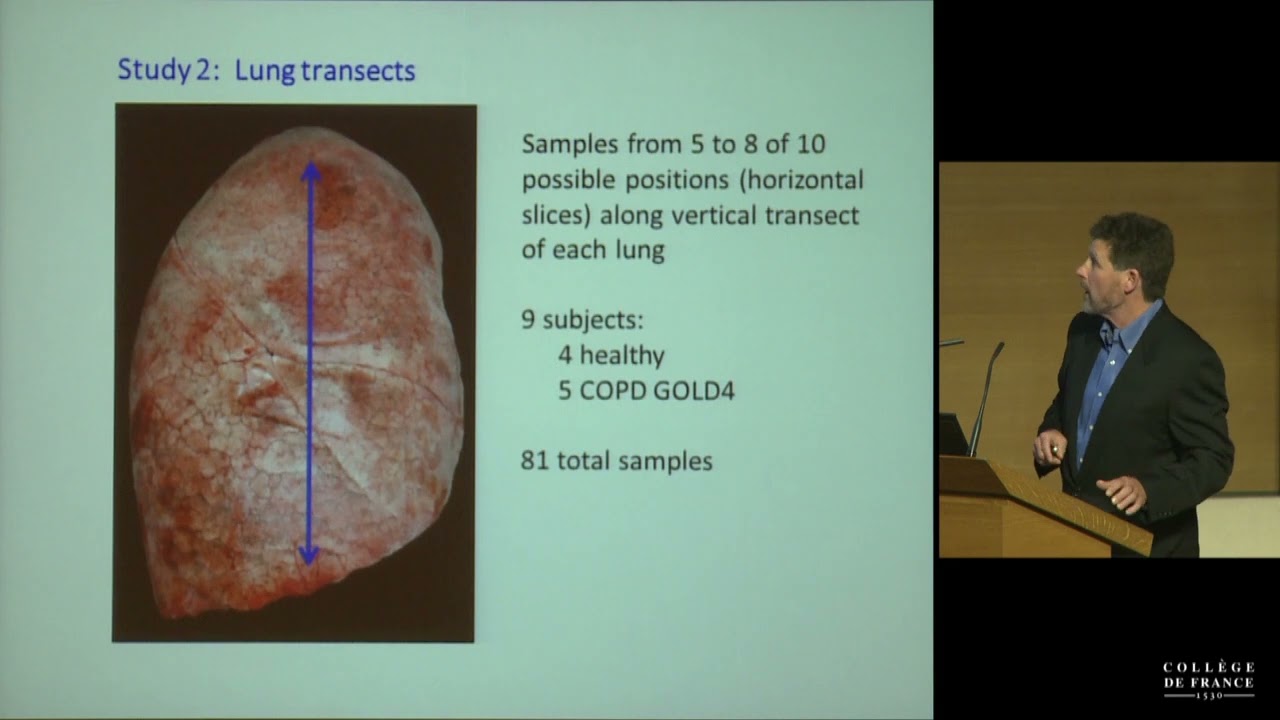 Microbiota, Nutrition and Metabolism (10) - Philippe Sansonetti (2013-2014)