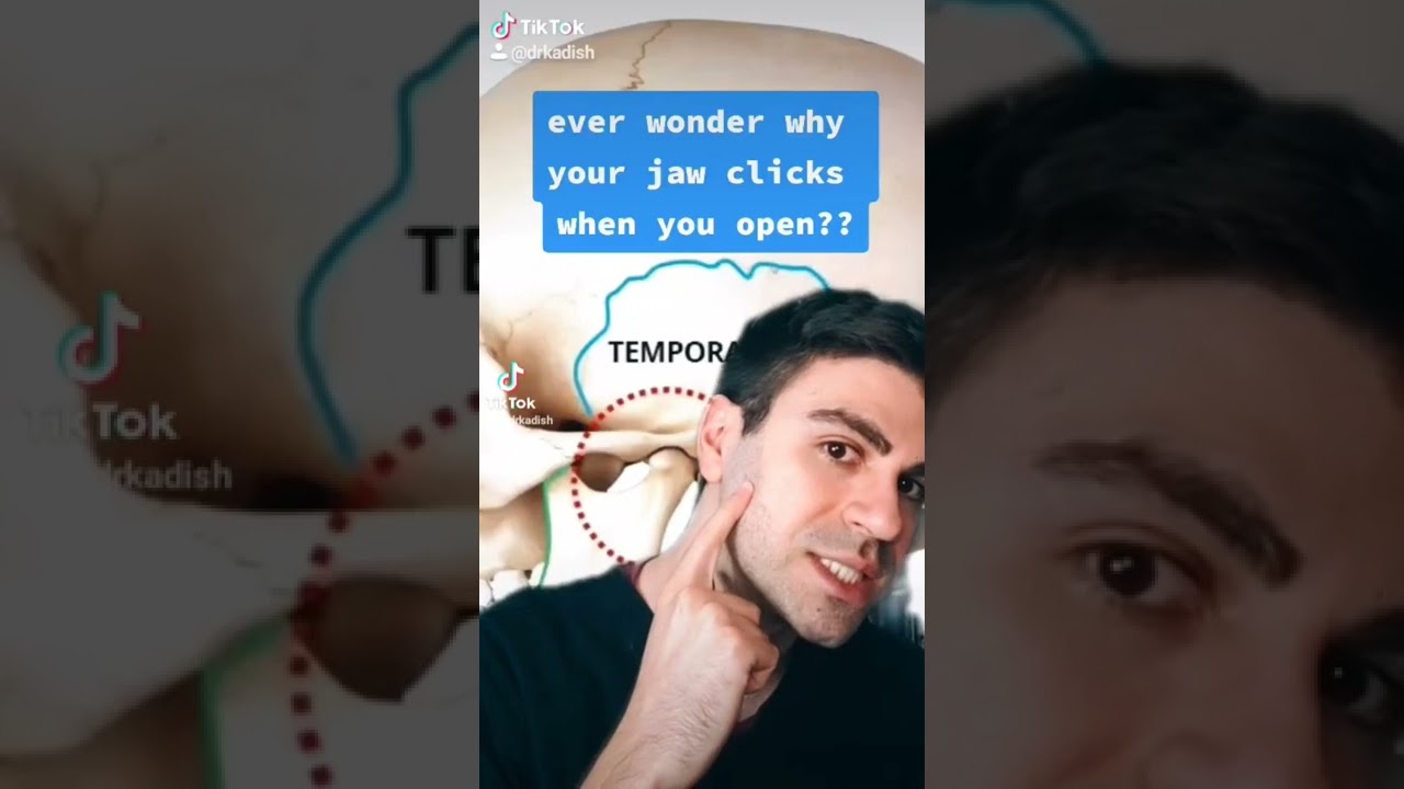 Why Is There A Click When I Open?? #tmj #dentist #doctor #click
