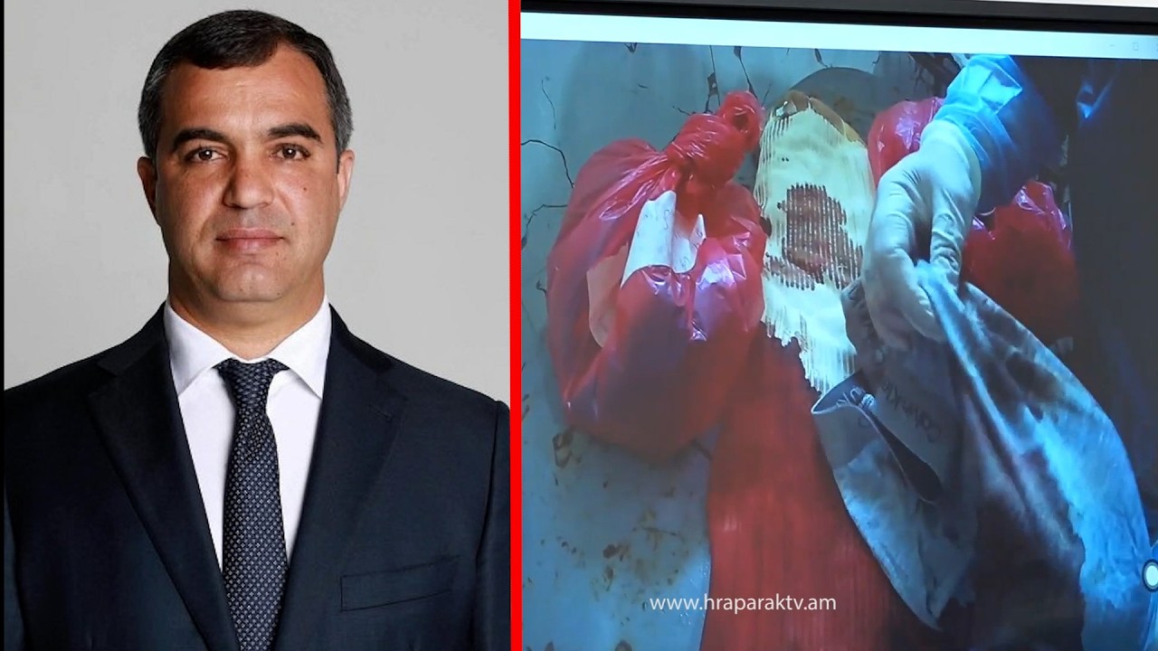 Վալոդյա Գրիգորյանի արյունոտ հագուստներն են ցուցադրվում. ինչ է ներկայացնում բժիշկը