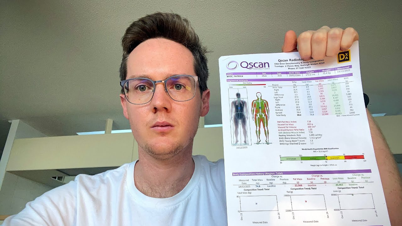 Receiving My SCARY DEXA Scan Results