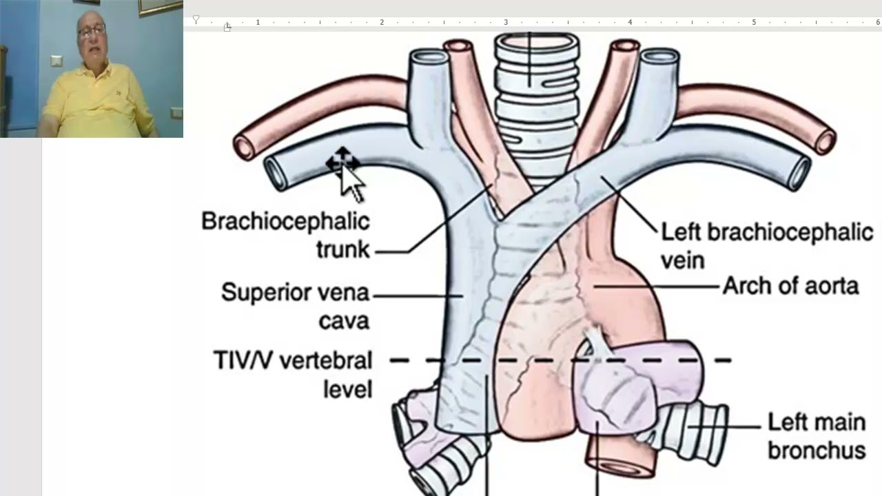 Anatomy CVS Module in Arabic 21 ( Superior mediastinum) ,  by Dr, Wahdan