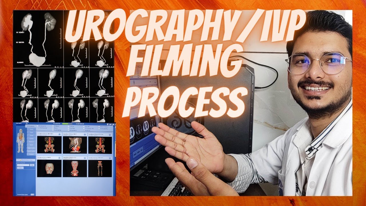 CT SCAN KUB Contrast/Urography/IVP Filming process on GE Revolution Machine | #ctscan