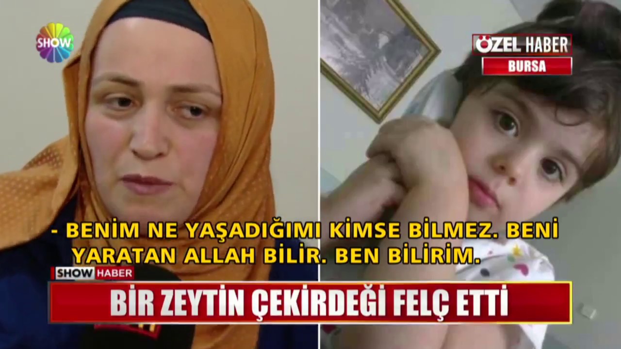 Bir zeytin çekirdeği felç etti