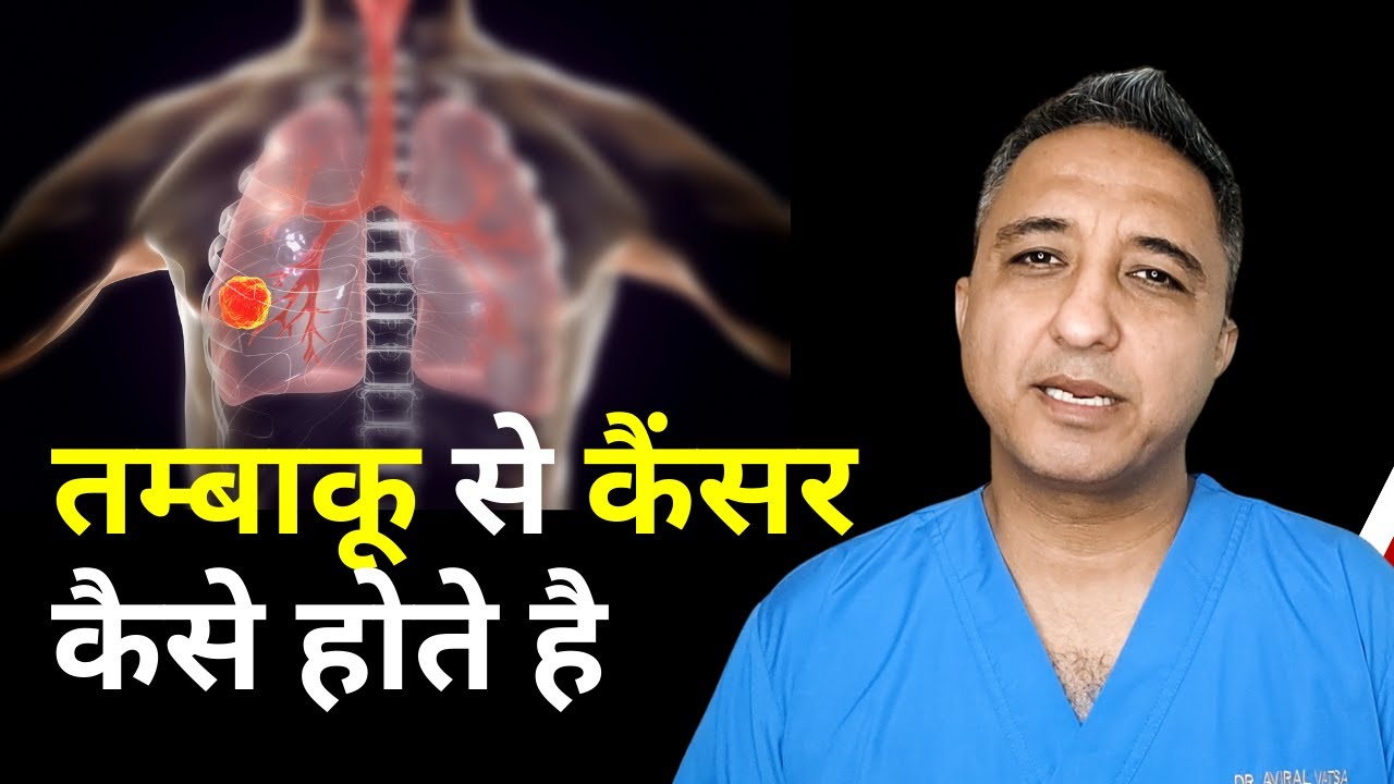 क्या आपने कभी सोचा है सिगरेट बीड़ी पीने से कैंसर कैसे होते है?