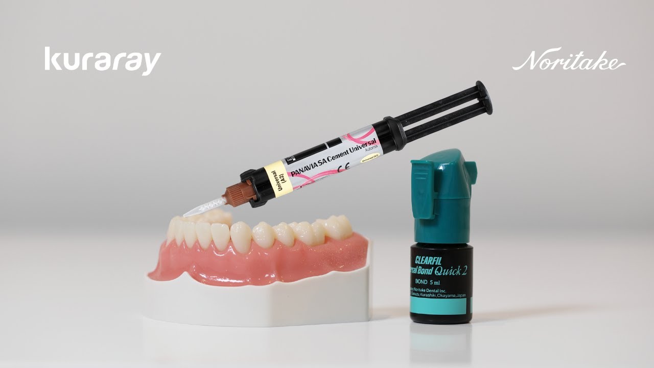 How to cement indirect restorations | CLEARFIL Universal Bond Quick 2 - PANAVIA SA Cement Universal