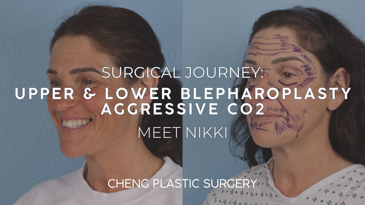 SURGICAL JOURNEY Part 1: Meet Nikki