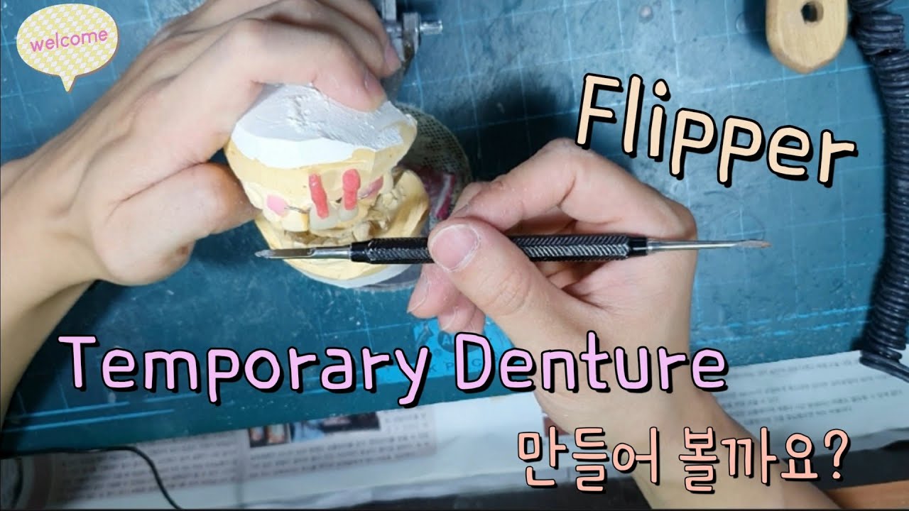 [극한직업] 치과기공사 Flipper 제작, 입벌려 인공치들어간다 (Temporary Denture)