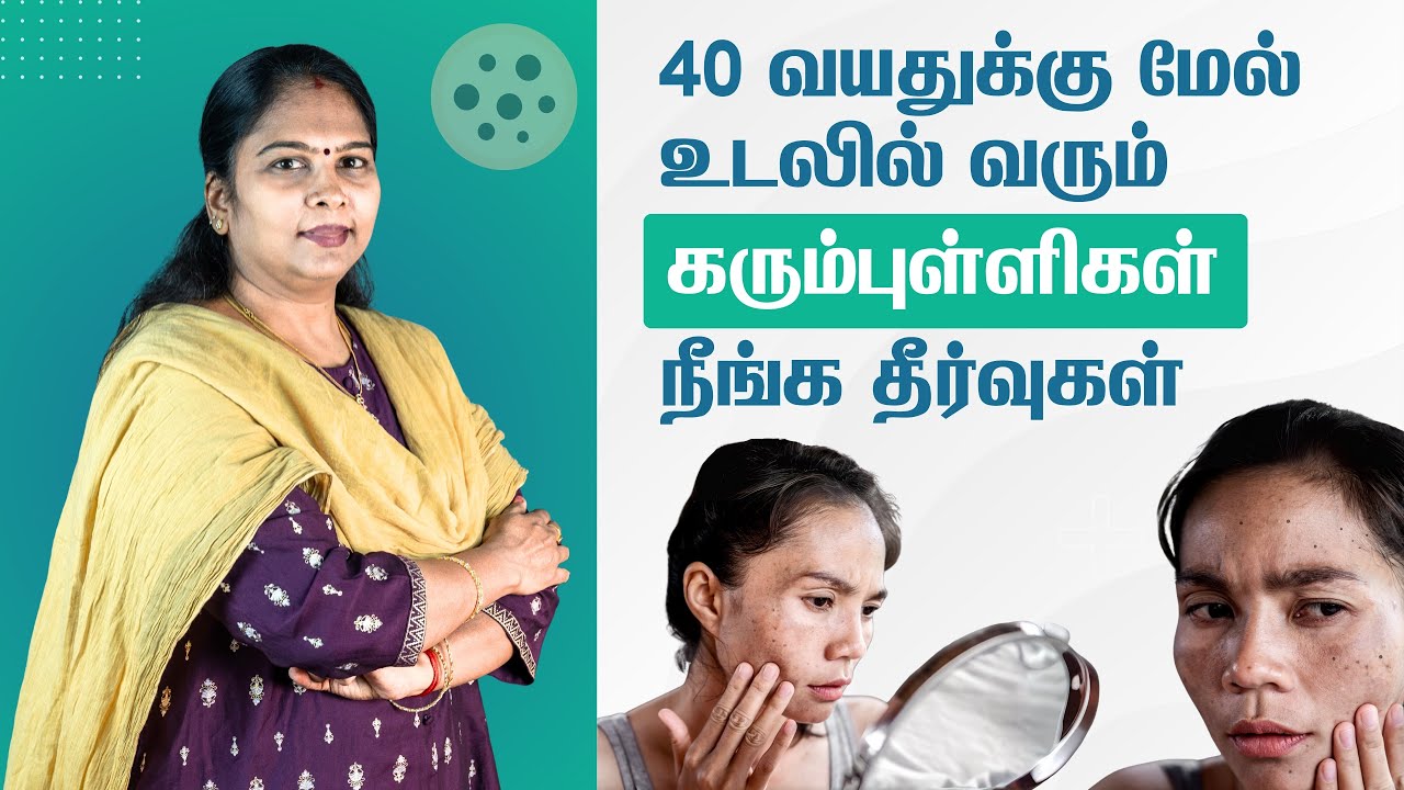 Tips to remove dark spots | 40 வயதில் வரும் கரும்புள்ளிகள் நீங்க தீர்வுகள் | Age Spots | Liver Spots