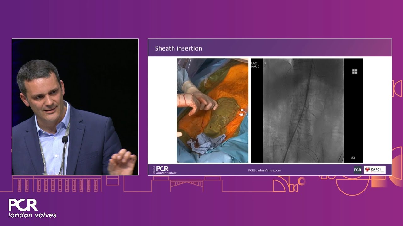 Essentials of lifetime management of TAVI patients - PCR London Valves 2023