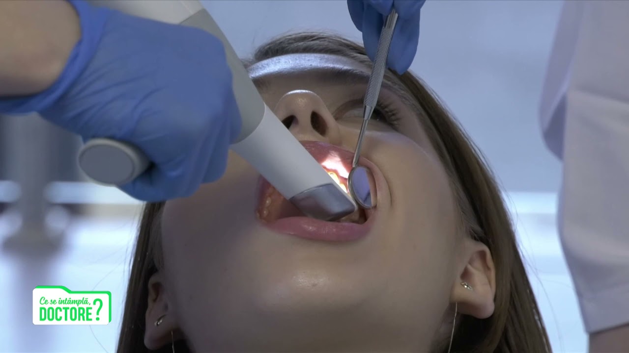 De ce este recomandat să nu mâncăm lactate după intervenții chirugicale la nivelul cavității orale