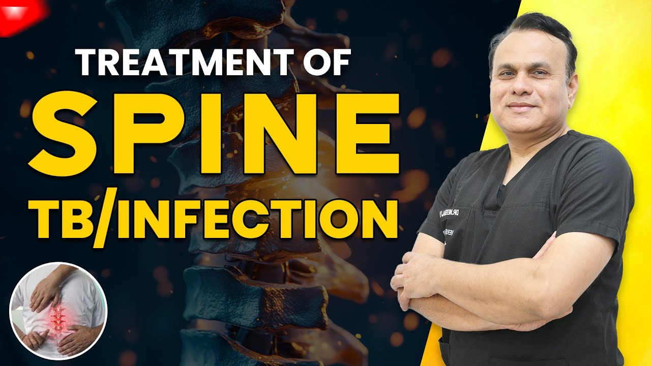 Spine TB Ka Ilaj | Spinal Infection Treatment – Complete Recovery Possible? #spine #tb #infection