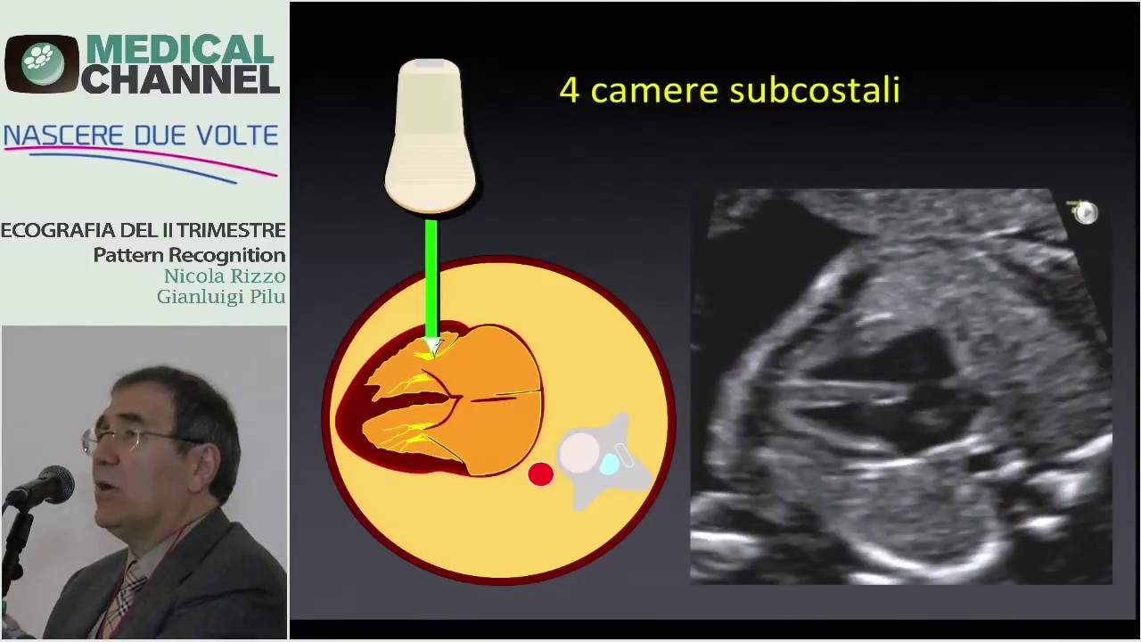 Ecografia del Cuore fetale