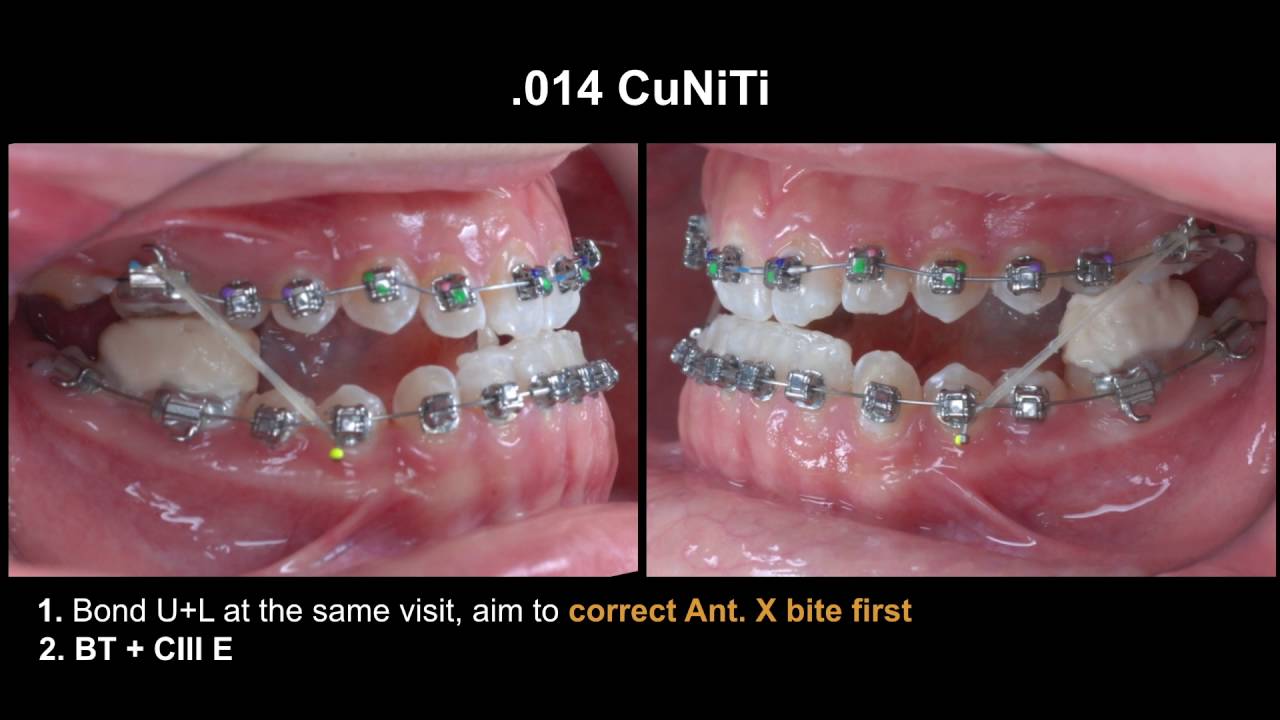 CC382. Clinical Tips CIII FS