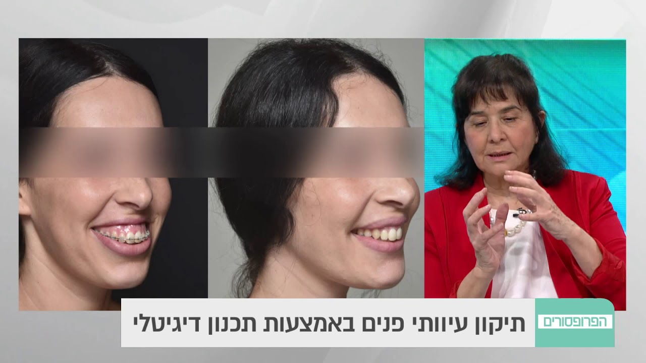 אורתוכירורגיה - ניתוחים לתיקון אסימטריה ועיוותים בפנים
