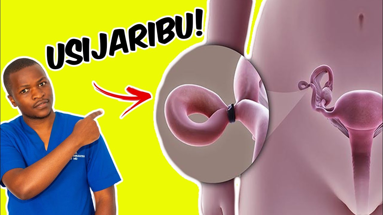 Sikiliza: Usifunge Uzazi Kwa Kufunga Mirija Kama Bado Unataka Kuzaa? | Kufunga Mirija Ya Uzazi