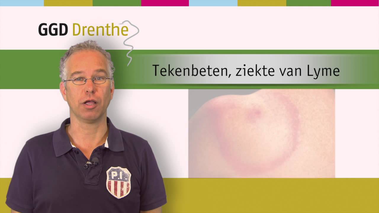 Tekenbeten en ziekte van lyme