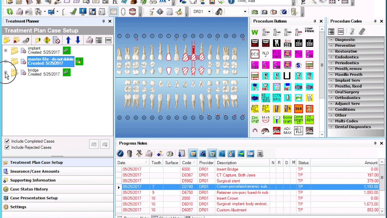 Dentrix Chairside Planner