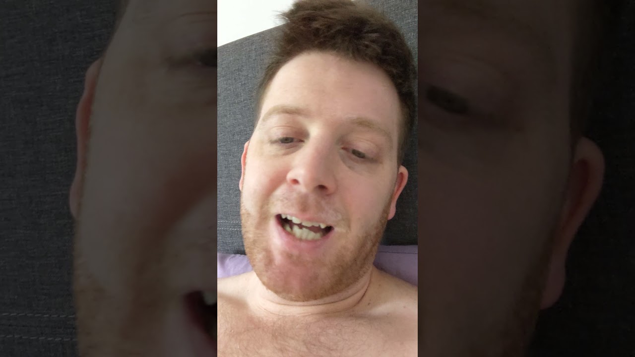 Achilles tendon rupture week 8 non surgery conservative method #nhs