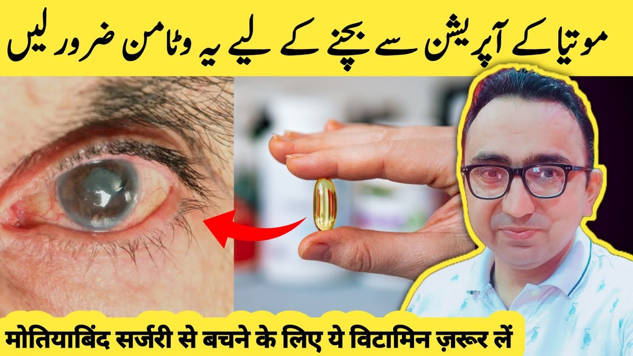 4 Best Vitamins to Prevent Eye Diseases! ( Cataract & Glaucoma )