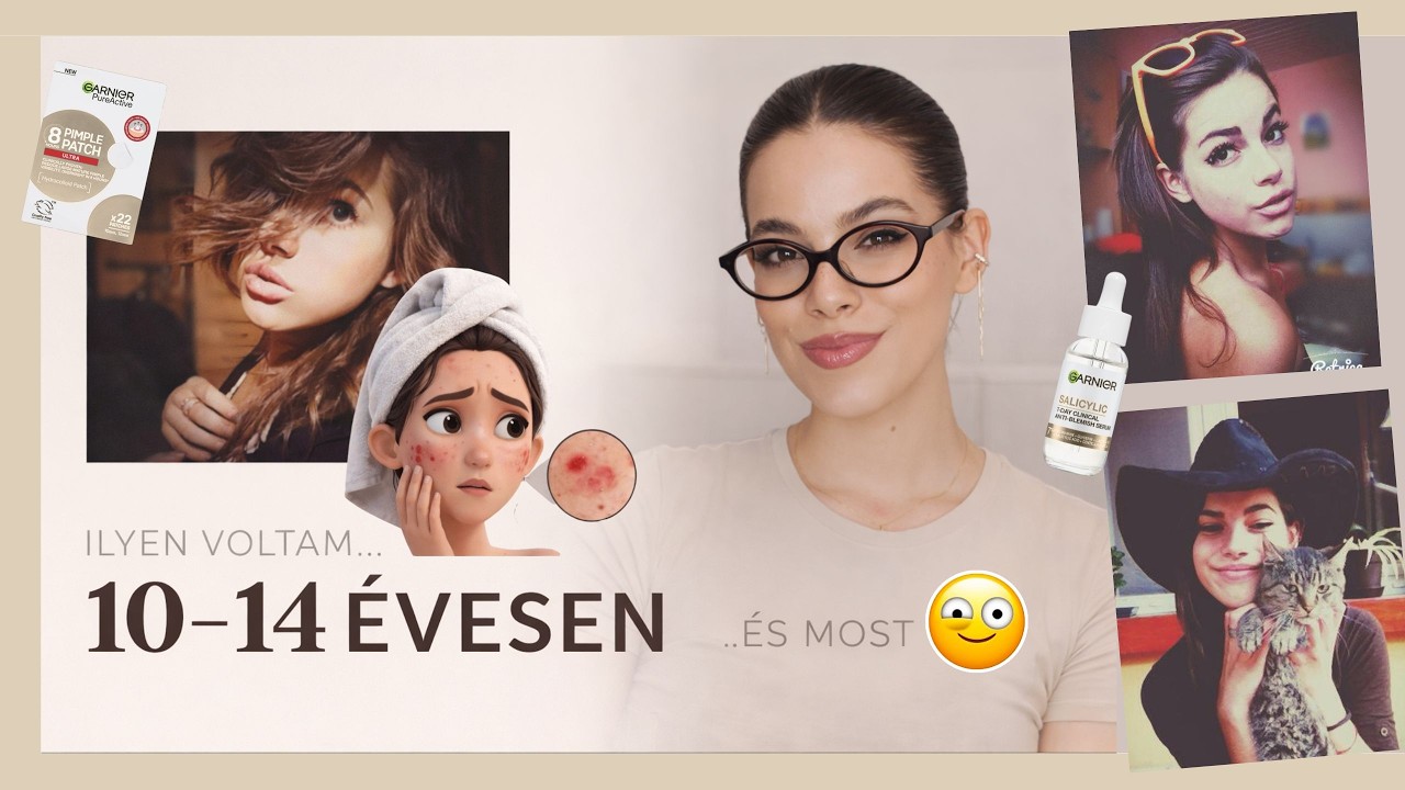 ÍGY NÉZTEM KI 10–14 ÉVESEN… 😬 (pattanások, cringe fotók) I Rózsahegyi Csenge