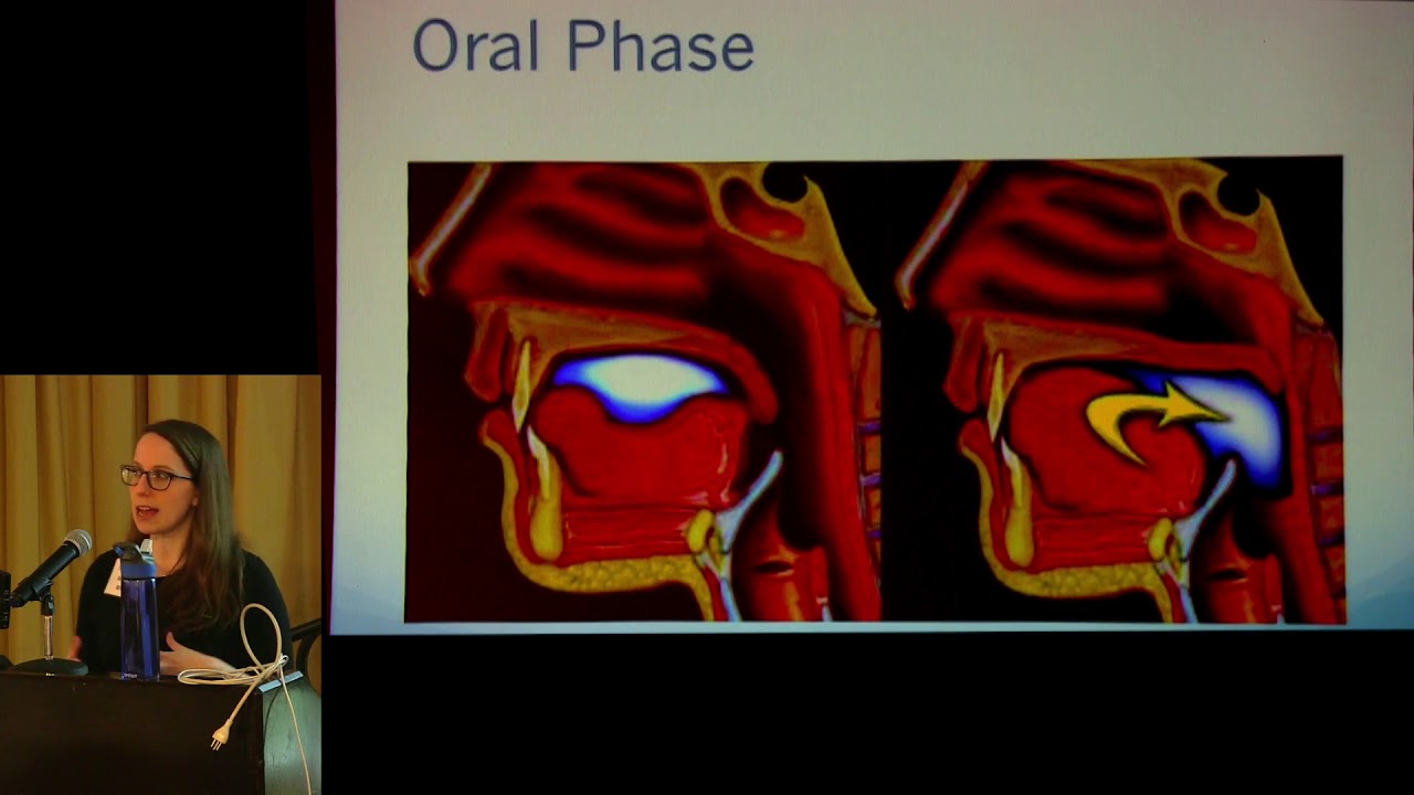 2019 NCSummit: Dysphagia & Speech Therapy - Michelle Wilson, CCC-SLP