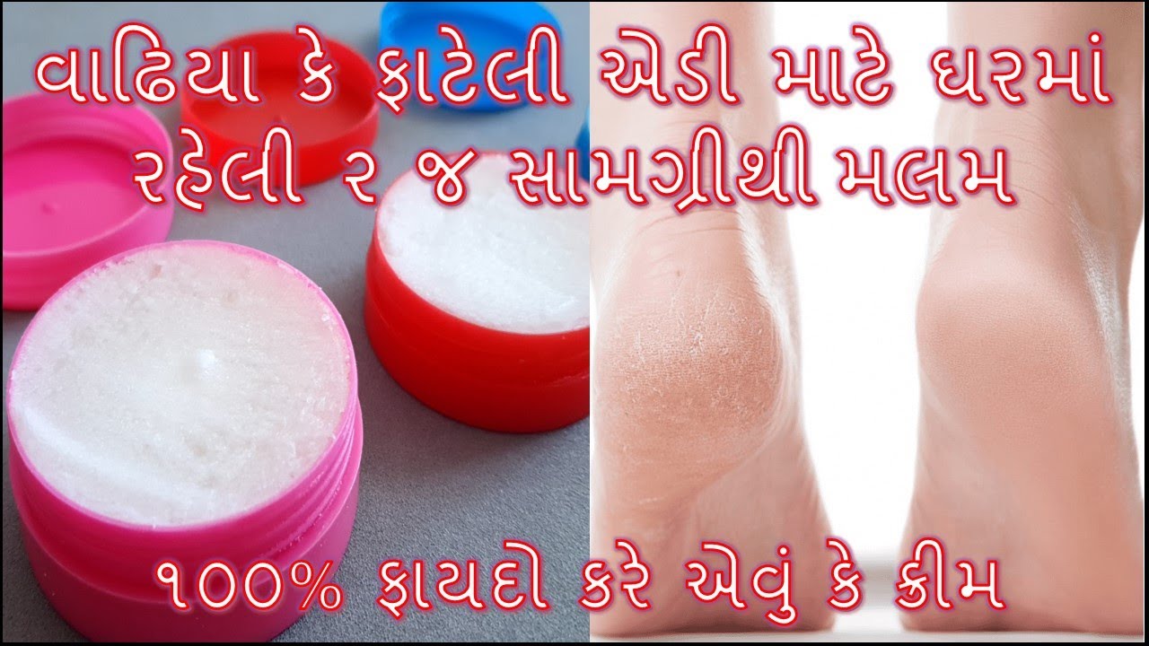 ફકત 5 મીનીટમા વાઢિયા કે ફાટેલી એડી માટે ઘરમાં રહેલી ૨ જ સામગ્રીથી ક્રીમ/Cracked Heels Home Remedy