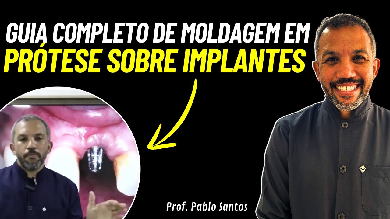 Guia Completo de Moldagem em Prótese sobre Implantes