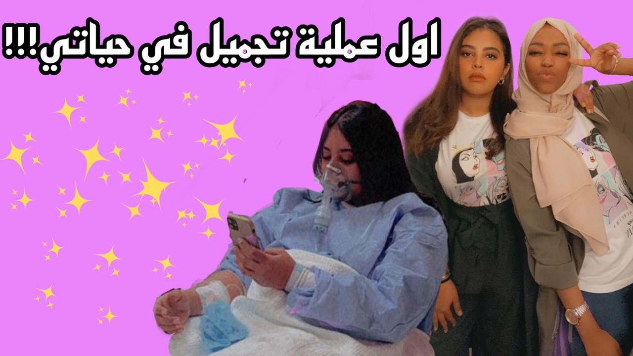 سويت اول عملية تجميل في حياتي 🔥🔥🔥🔥🔥 النتيييييجة وااااااو