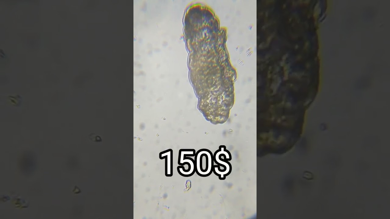 MICROSCOPE FOR $150 OR $1500