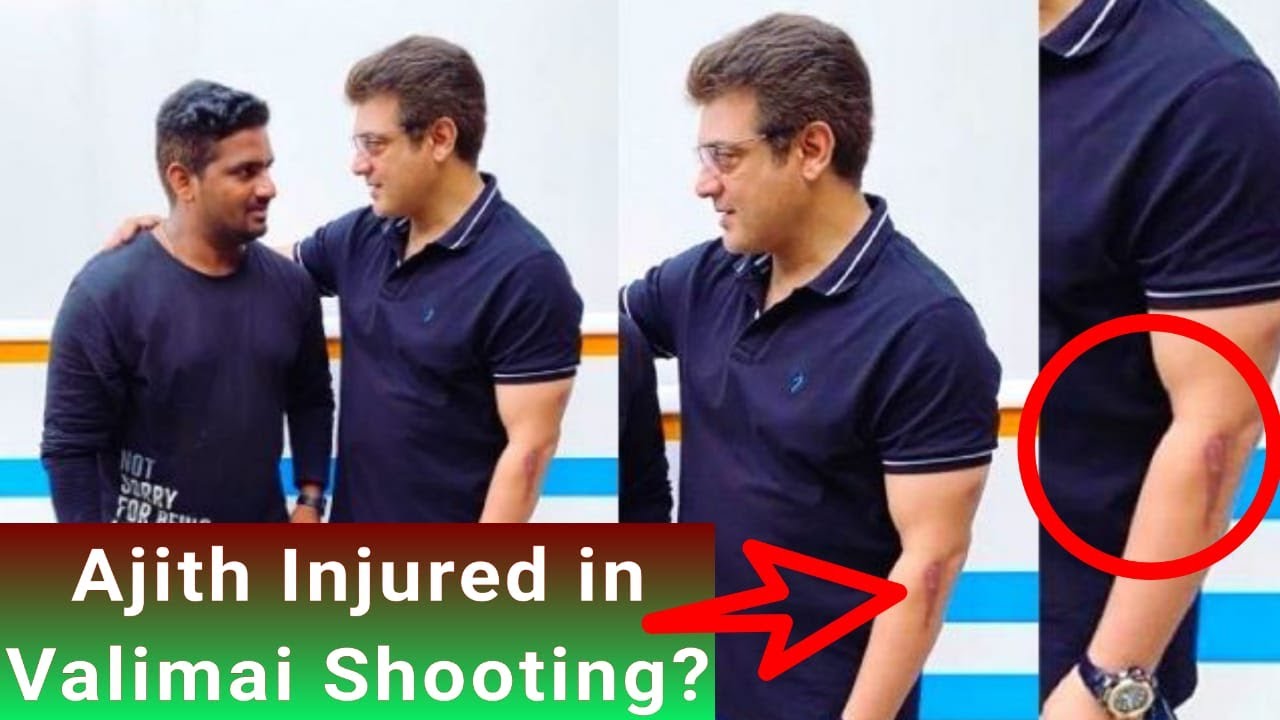 ThalaAjith injured in Valimai Shooting spot???? Photo released from shooting spot.