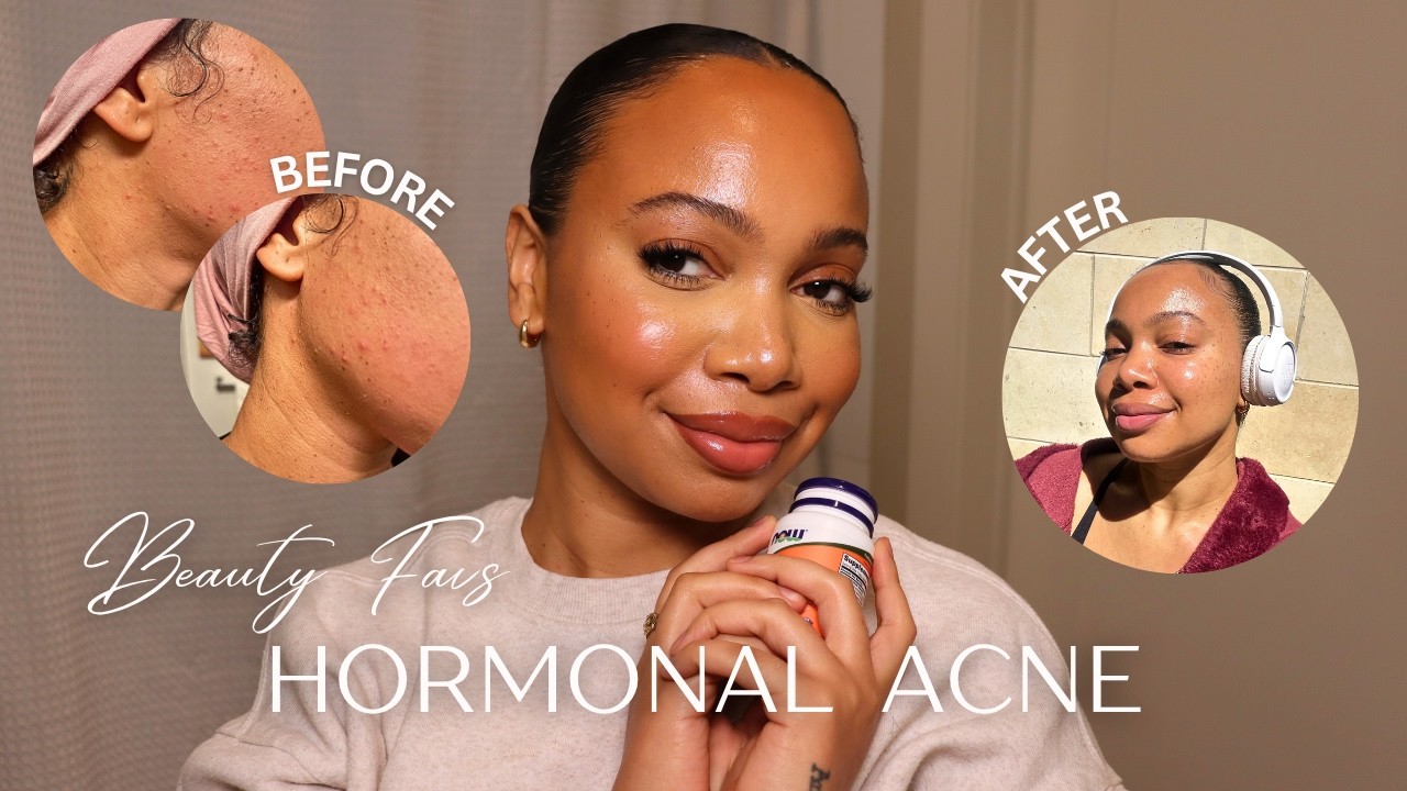 MY CURRENT BEAUTY FAVS FOR HORMONAL ACNE