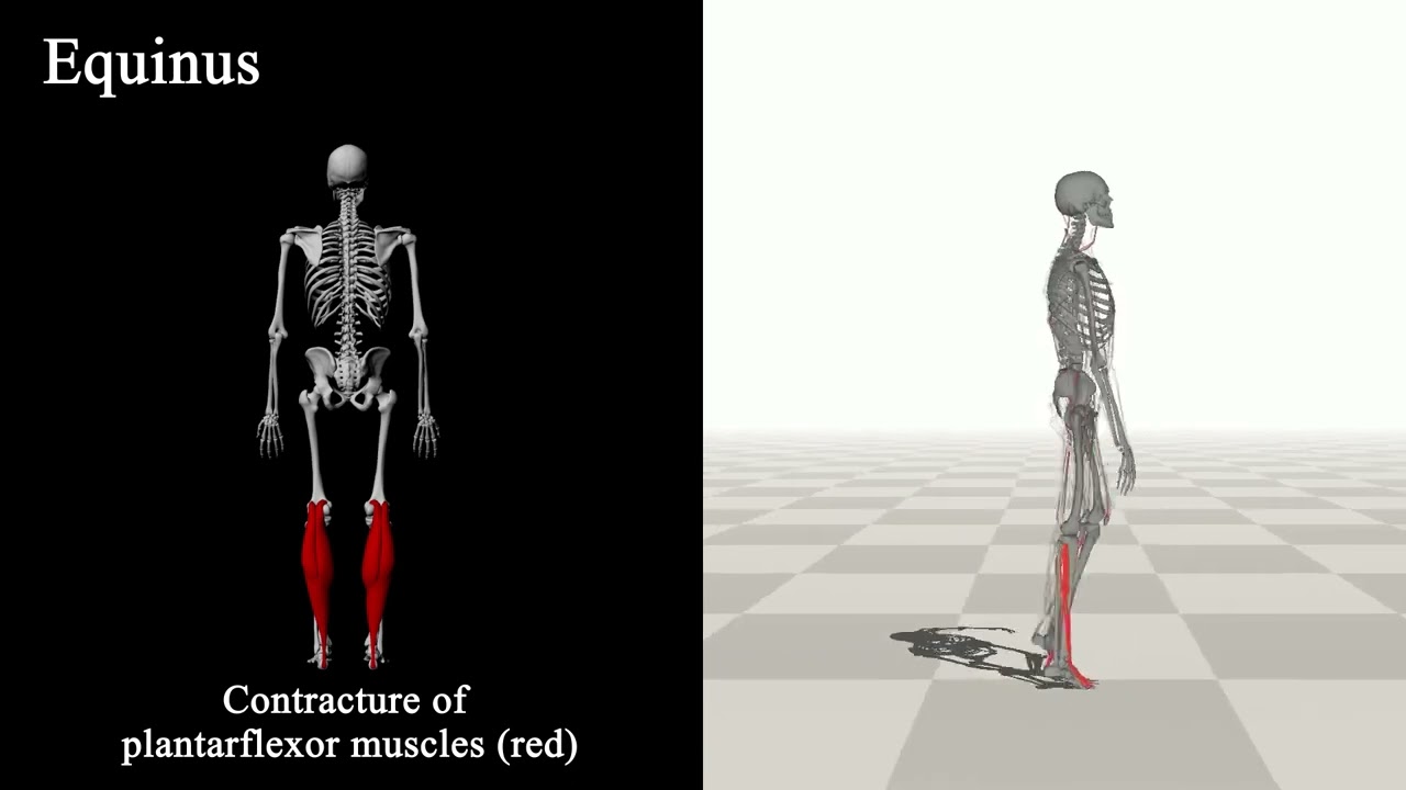 Generative GaitNet (SIGGRAPH 2022)