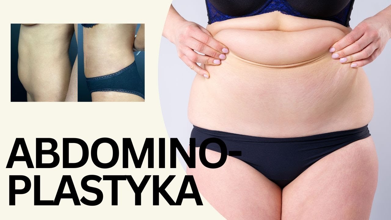 Abdominoplastyka - Odzyskaj Płaski Brzuch i Pewność Siebie!